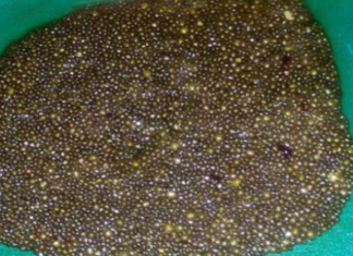 იგი ექიმთან მივიდა კუჭის ტკივილით, მაგრამ როცა ეს აღმოაჩინა შოკირებული იყო..