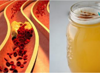 დაემშვიდობეთ, როგორც მაღალ არტერიულ წნევას, ასევე დაბლოკილ არტერიებს!! ამაში კი, ამ წამლის 4 ს/კ. დაგეხმარებათ..