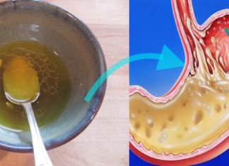 ცარიელ კუჭზე ამ სასმელის მიღებით გაიუმჯობესეთ ღვიძლის ჯანმრთელობა!!..