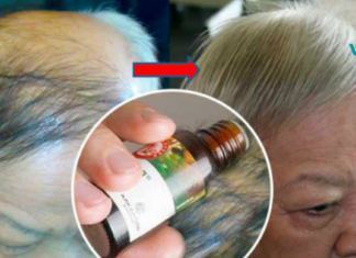 ამ ზეთის 5 წვეთის გამოყენებით 1 თვეში თავს დააღწევთ გამელოტებას და აღადგენთ თმის ზრდას!!