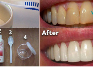 როგორ მოვიშოროთ ნადები და გავითეთროთ კბილები ძვირადღირებული პროცედურების გარეშე!!