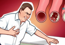 20 არაჩვეულებრივი საკვები, რომელსაც შეუძლია გაწმინდოს თქვენი არტერიები და დაგიცავთ გულის შეტევისგან!