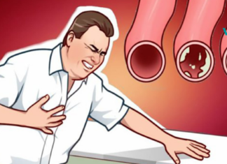 20 არაჩვეულებრივი საკვები, რომელსაც შეუძლია გაწმინდოს თქვენი არტერიები და დაგიცავთ გულის შეტევისგან!