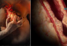 ნუ უგულებელყოფთ ამ სტატიას! გულის შეტევის დროს გადარჩენის შანსების გაზრდის გზები..