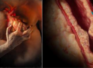 ნუ უგულებელყოფთ ამ სტატიას! გულის შეტევის დროს გადარჩენის შანსების გაზრდის გზები..