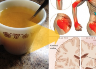 10 მიზეზი, რის გამოც ყოველ დილით ყველამ უნდა დალიოს თბილი წყალი კურკუმით!!