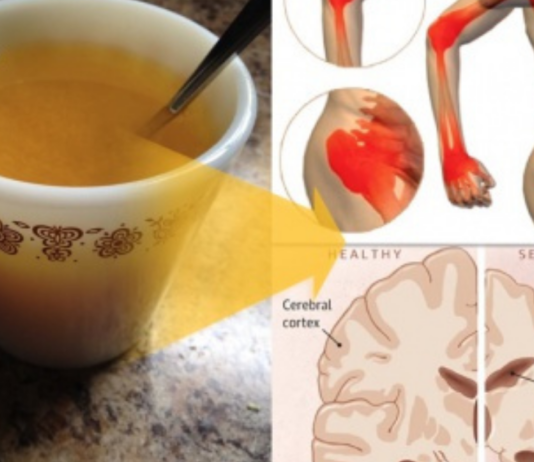 10 მიზეზი, რის გამოც ყოველ დილით ყველამ უნდა დალიოს თბილი წყალი კურკუმით!!