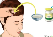 როგორ ვუმკურნალოთ თავის წყლულს? აქ აღმოაჩენთ ისეთ რამეს, რაც ნამდვილად გამოგადგებათ!