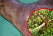 აი, როგორ მოაგვარა ბაბუამ დიაბეტთან დაკავშირებული ყველა პრობლემა სულ რაღაც 7 დღეში! მას შემდეგ არანაირ პრობლემას აღარ შეუწუხებია ის