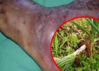 აი, როგორ მოაგვარა ბაბუამ დიაბეტთან დაკავშირებული ყველა პრობლემა სულ რაღაც 7 დღეში! მას შემდეგ არანაირ პრობლემას აღარ შეუწუხებია ის