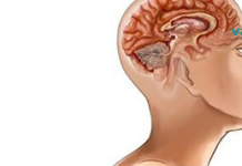 როგორ გაავარჯიშოთ ტვინი, რომ შეწყვიტოს ზედმეტი წუხილი და შფოთვა ?! საჭირო ტექნიკების ცოდნა ყველას გამოადგება..