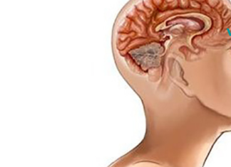 როგორ გაავარჯიშოთ ტვინი, რომ შეწყვიტოს ზედმეტი წუხილი და შფოთვა ?! საჭირო ტექნიკების ცოდნა ყველას გამოადგება..