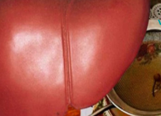 შეგიძლიათ მიიღოთ ეს სასმელი მუცლის ცხიმის დასაწვავად და ღვიძლის გასაწმენდად!! და რაც მთავარია დალიეთ ის ძილის წინ!