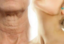 ჩვენ გასწვალით, რა უნდა გააკეთოთ იმისათვის, რომ თქვენი კისერი კვლავ ახალგაზრდულად გამოიყურებოდეს!! ძალიან მარტივი საშუალება..