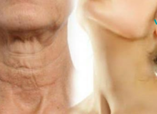 ჩვენ გასწვალით, რა უნდა გააკეთოთ იმისათვის, რომ თქვენი კისერი კვლავ ახალგაზრდულად გამოიყურებოდეს!! ძალიან მარტივი საშუალება..