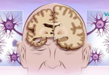 დამოკიდებულების 12 ადრეული გამაფრთხილებელი ნიშანი, რომელიც 40 წელს გადაცილებულმა ადამიანებმა უნდა იცოდნენ!!