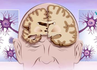 დამოკიდებულების 12 ადრეული გამაფრთხილებელი ნიშანი, რომელიც 40 წელს გადაცილებულმა ადამიანებმა უნდა იცოდნენ!!