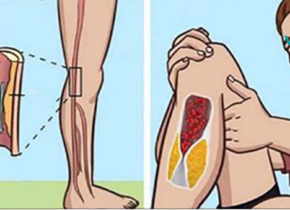 7 გამაფრთხილებელი ნიშანი, რომ დაბინდული გაქვთ არტერიები!