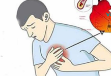 გულის შეტევის გამაფრთხილებელი ნიშნები, რომლებიც არ უნდა უგულებელყოთ!