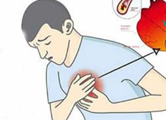 გულის შეტევის გამაფრთხილებელი ნიშნები, რომლებიც არ უნდა უგულებელყოთ!