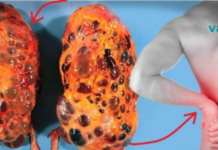 წარმოგიდგენთ 8 მავნე ჩვევას, რომლებმაც შეიძლება დააზიანოს თქვენი თირკმელები!