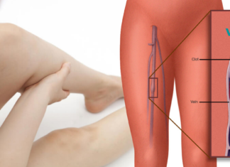 დარღვეული სისხლის მიმოქცევის 8 საშიში ნიშანი, რომელსაც ჩვენ ჩვეულებრივ უგულებელყოფთ!!