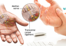 გაწუხებთ ისეთი მდგომარეობა, როგორიცაა ხელების დაბუჟება, ტკივილი ან თუნდაც სისუსტე? 8 ბუნებრივი გზა ტკივილის შესამსუბუქებლად!