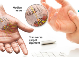 გაწუხებთ ისეთი მდგომარეობა, როგორიცაა ხელების დაბუჟება, ტკივილი ან თუნდაც სისუსტე? 8 ბუნებრივი გზა ტკივილის შესამსუბუქებლად!