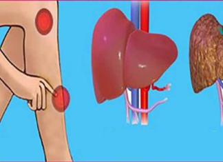 10 გამაფრთხილებელი ნიშანი იმისა, რომ თქვენი ღვიძლი გამართულად არ ფუნქციონირებს. ფრთხილად! ეს ტოქსინები გროვდება თქვენს ცხიმოვან ქსოვილებში!