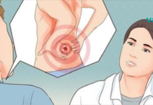 ამ მარტივ საშინაო საშუალებას შეუძლია ბუნებრივად დაგეხმაროთ ზურგის ტკივილისა და საჯდომი ნერვის (იშიაზის) შემსუბუქებაში!!