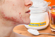 გამოიყენეთ ეს გასაოცარი საშუალება აკნეს მოსაშორებლად! ნამდვილად ეფექტური ინსტრუმენტია!