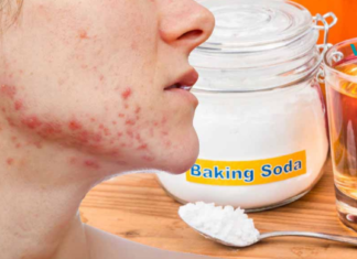 გამოიყენეთ ეს გასაოცარი საშუალება აკნეს მოსაშორებლად! ნამდვილად ეფექტური ინსტრუმენტია!