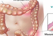 4 ნაბიჯი ნაწლავის გაზრდილი გამტარიანობისა და აუტოიმუნური დაავადების სამკურნალოდ!