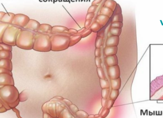 4 ნაბიჯი ნაწლავის გაზრდილი გამტარიანობისა და აუტოიმუნური დაავადების სამკურნალოდ!