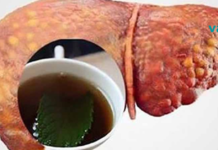 სასმელი, რომელიც საოცრად წმენდს ღვიძლს და ეფექტურად წვავს მუცლის ცხიმსაც!