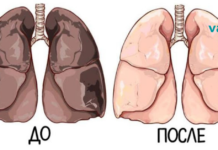 შეურიეთ ამ ინგრედიენტს ფორთოხლის წვენი და გაწმინდეთ ნიკოტინისგან თქვენი ორგანიზმი!