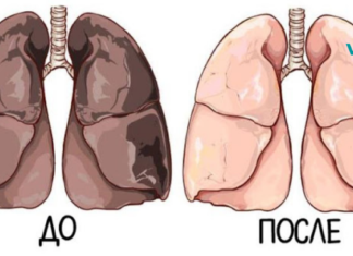 შეურიეთ ამ ინგრედიენტს ფორთოხლის წვენი და გაწმინდეთ ნიკოტინისგან თქვენი ორგანიზმი!