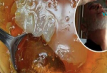 ცნობილმა ოფთალმოლოგმა გაგვიზიარა რეცეპტი, რომელსაც შეუძლია თავიდან აგაცილოთ მხედველობის დაკარგვა!!