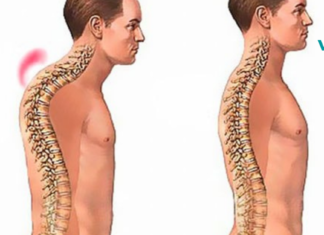 გსურს გქონდეს ჯანსაღი ხერხემალი? არაფერია ამაზე უფრო ადვილი!