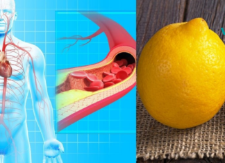 არტერიების გასუფთავება ნიორის და ლიმონის დახმარებით. ყველაზე ეფექტური საშუალებაა!