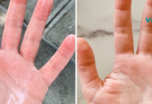 ეს უნდა წაიკითხოთ: როგორ ხდება ბუნებრივი გზით ოფლიანობის თავიდან აცილება!