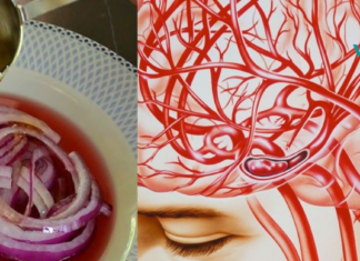 გაიწმინდეთ თავის ტვინის სისხლძარღვები ამ ნატურალური რეცეპტების საშუალებით..