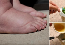 ეს ხალხური საშუალებები დაგავიწყებენ ფეხების შეშუპების პრობლემას! დღესვე სცადეთ და თავადვე დარწმუნდებით ამაში..