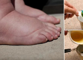 ეს ხალხური საშუალებები დაგავიწყებენ ფეხების შეშუპების პრობლემას! დღესვე სცადეთ და თავადვე დარწმუნდებით ამაში..