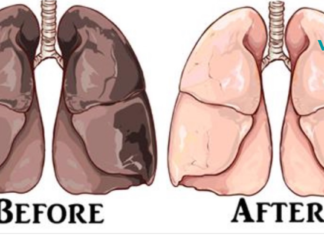 მოიშორეთ ნიკოტინი ფილტვებიდან ახლავე ამ მარტივი მიქსის დახმარებით!! ეს საშუალება შვება იქნება ყველასათვის..