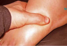 ორგანიზმში წყლის შეკავების 6 მიზეზი და როგორ შევაჩეროთ იგი!!