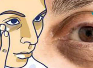 ეს არის ყველაზე მნიშვნელოვანი რამ, რაც სახლის პირობებში დაგეხმარებათ გაიქროთ  თვალებ ქვეშ არსებული მუქი წრეები!