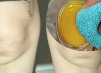 დღეს გვინდა გაგიზიაროთ საოცარი საშუალების რეცეპტი, რომელიც ექიმთან ვიზიტის გარეშე აღადგენს მუხლებში ხრტილს.