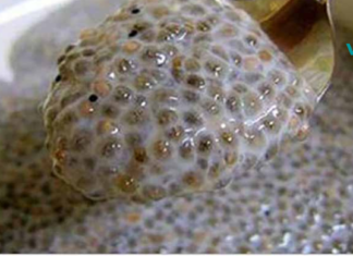 გაათავისუფლეთ თქვენი ნაწლავები ყველანაირი სახის ნარჩენებისგან! მხოლოდ და მხოლოდ ამ საშუალების ერთი კოვზით!