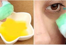 სახლის სამკურნალო საშუალებები თვალის ქვეშ არსებული მუქი წრეების გასაქრობად!